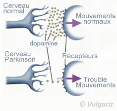 cerveau parkison dopamine