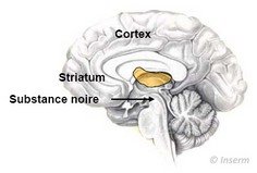 cerveau parkison